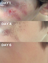 Load image into Gallery viewer, Before &amp; After of Child&#39;s Graze using Golden Dry Skin Miracle Salve
