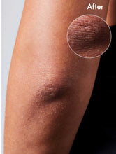 Load image into Gallery viewer, 101 Dry Skin Super Cream: Elbow after one use
