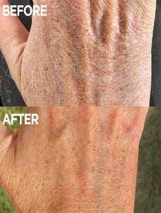 Before & After of Hand using Golden Dry Skin Miracle Salve