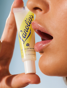 Model holding a Lemonaid Lip Treatment